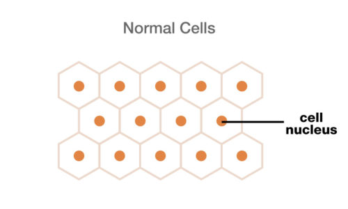 normal cells