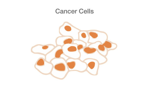 cancer cells