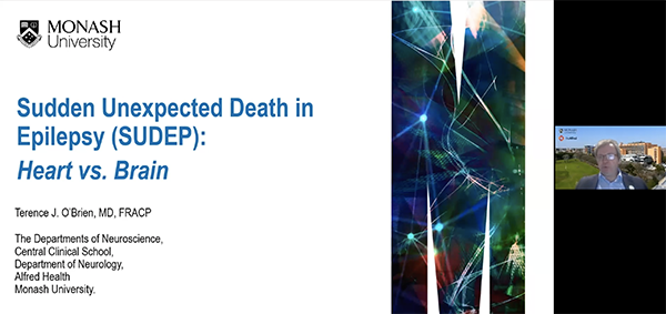 Sudden Unexpected Death in Epilepsy event